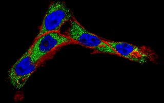 Cancer detecting nanoparticles from the National Cancer Institute \ M.D. Anderson Cancer Center