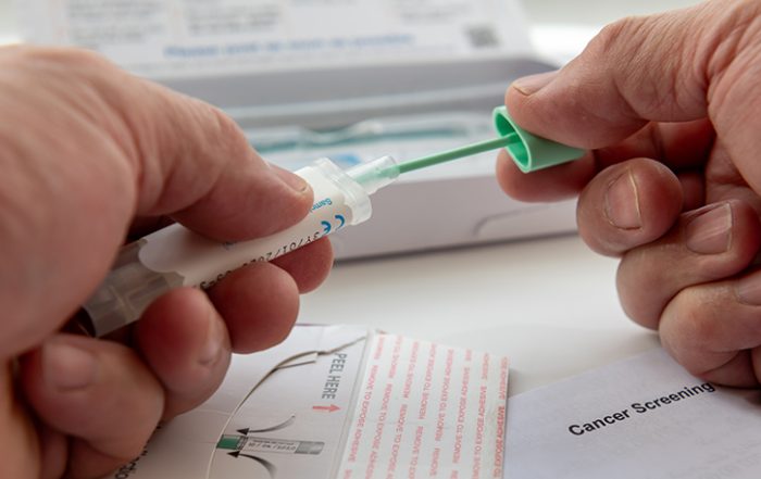 Photo of a person putting the colorectal cancer test sample in the sample holder before sending it off by mail for testing.